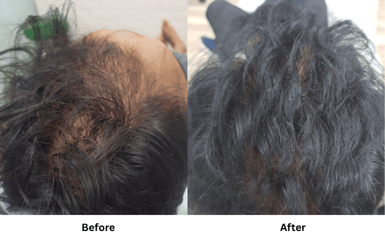 before & after of treatments (29)