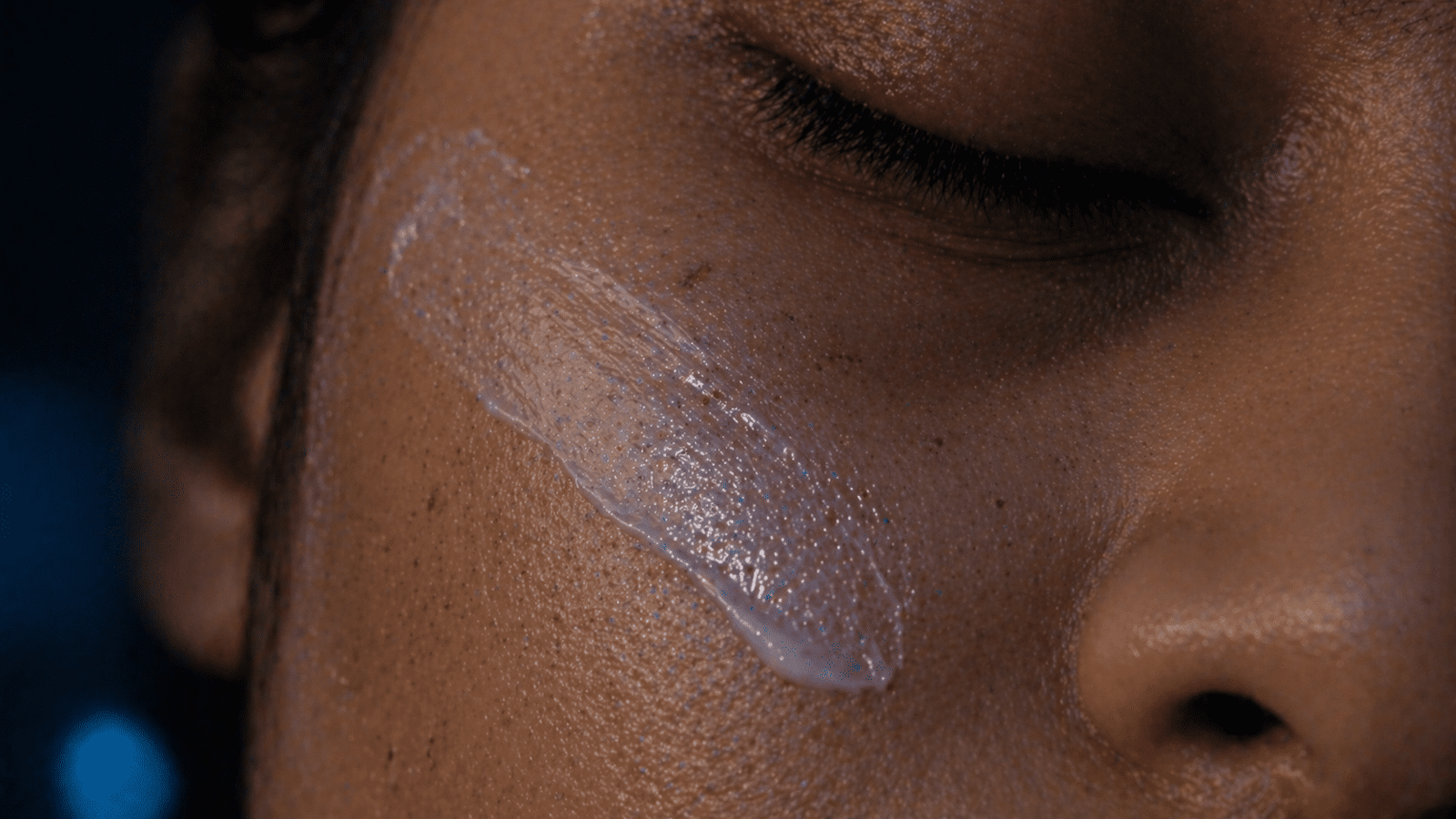 Retinoid topical treatment improving skin renewal on Indian skin at Brilliance Cosmocare Skin, Hair and Weightloss Clinic