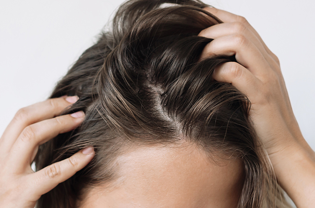 GFC Hair Treatment