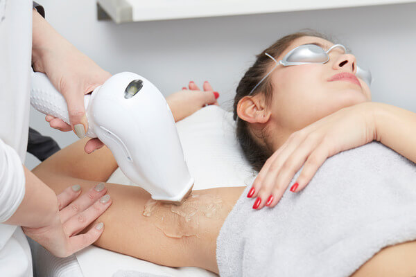 Laser-Hair-Removal-Brilliance-Cosmocare