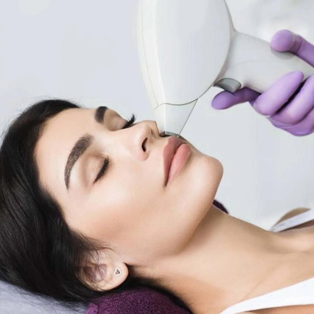 Laser Skin Resurfacing