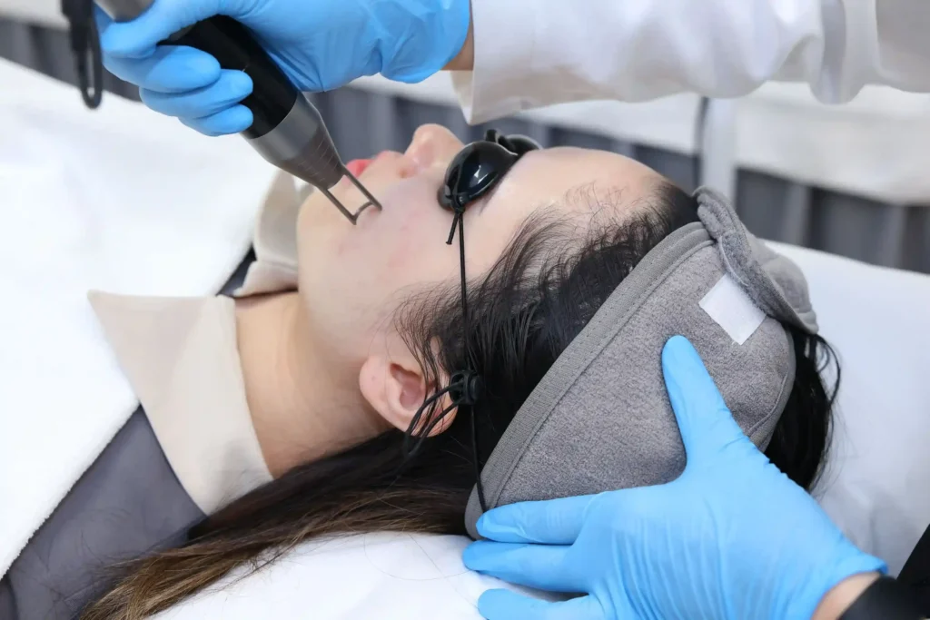 Nd YAG Laser Treatment