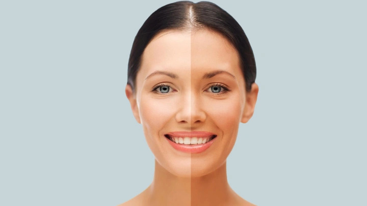 Skin Brightening Treatment