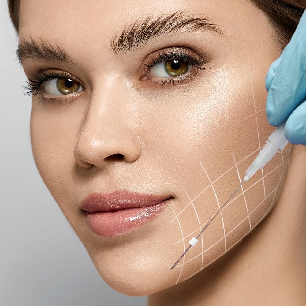 Thread Lift