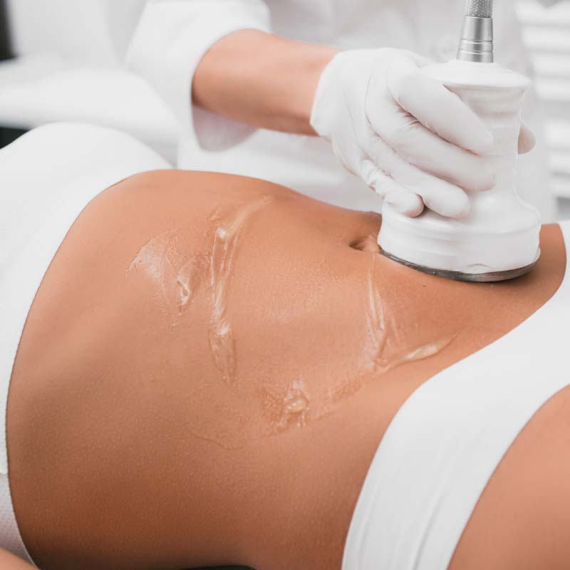 Ultrasound Fat Reduction