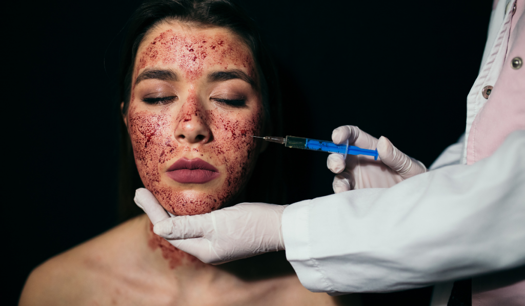 Vampire Facial Treatment