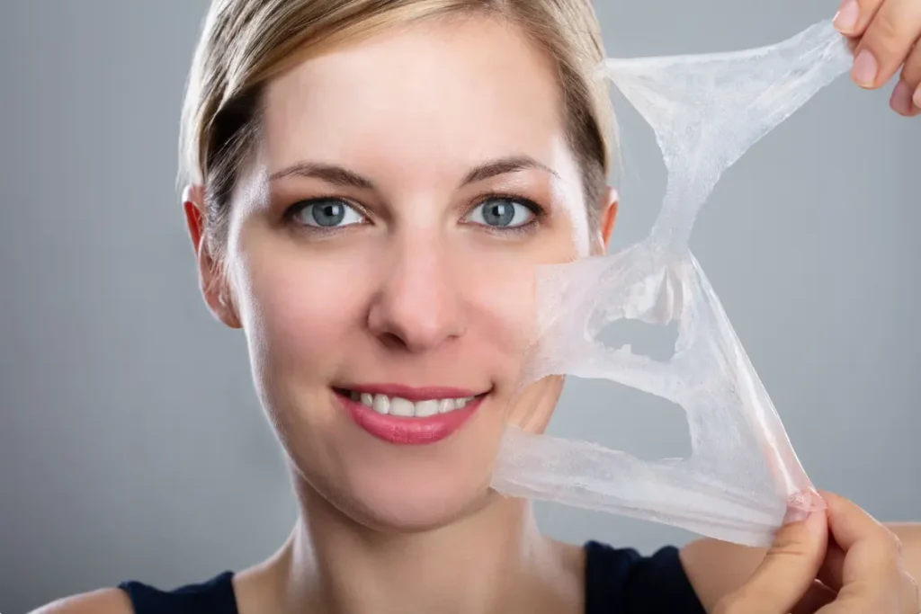 Chemical Peel Treatment