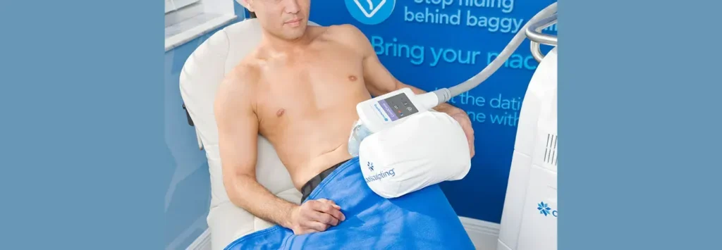 CoolSculpting (Cryolipolysis)