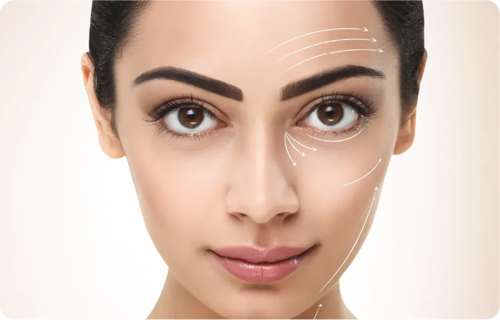 Wrinkle Reduction