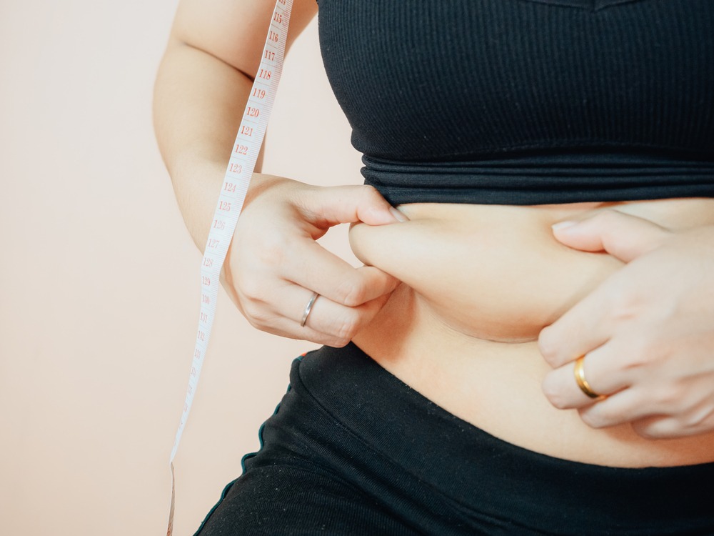 RF Fat Reduction