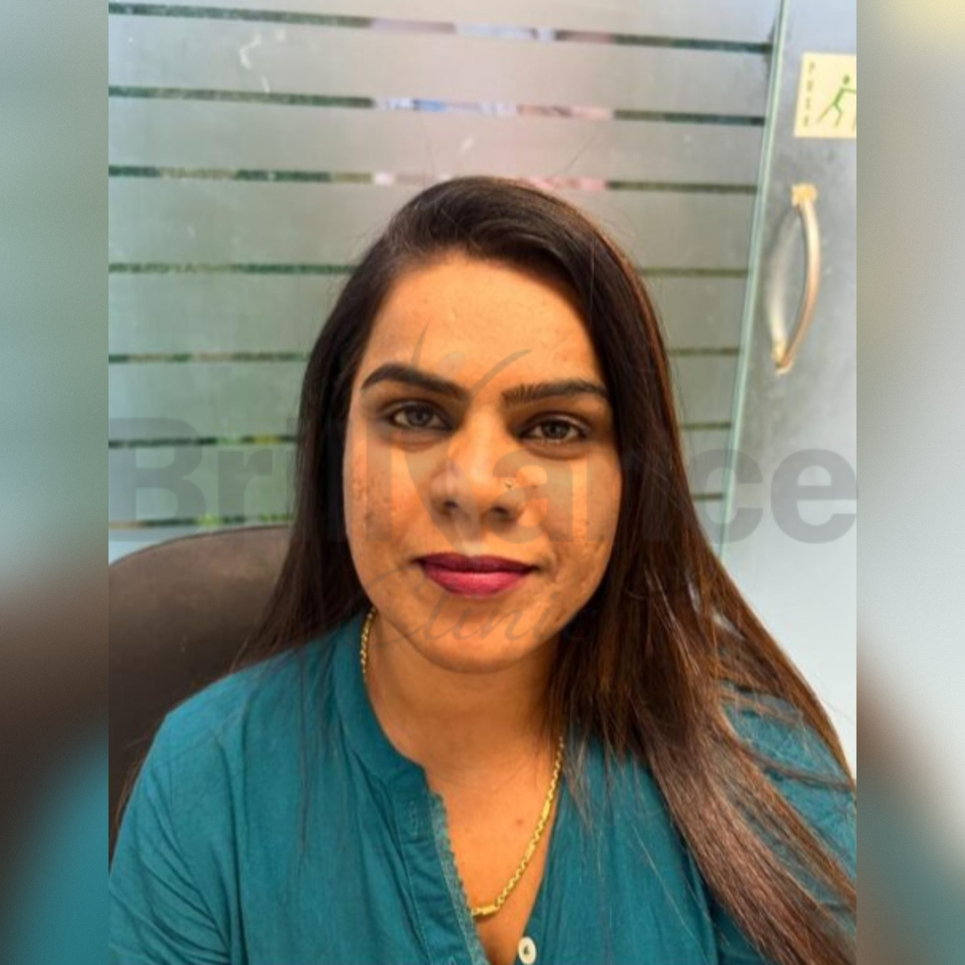 After image of Glutathione + Skin Peeling Combination Protocol Treatment from Brilliance Cosmcoare Hair, Skin & Weightloss Clinic in Dn Nagar, Andheri West, Mumbai