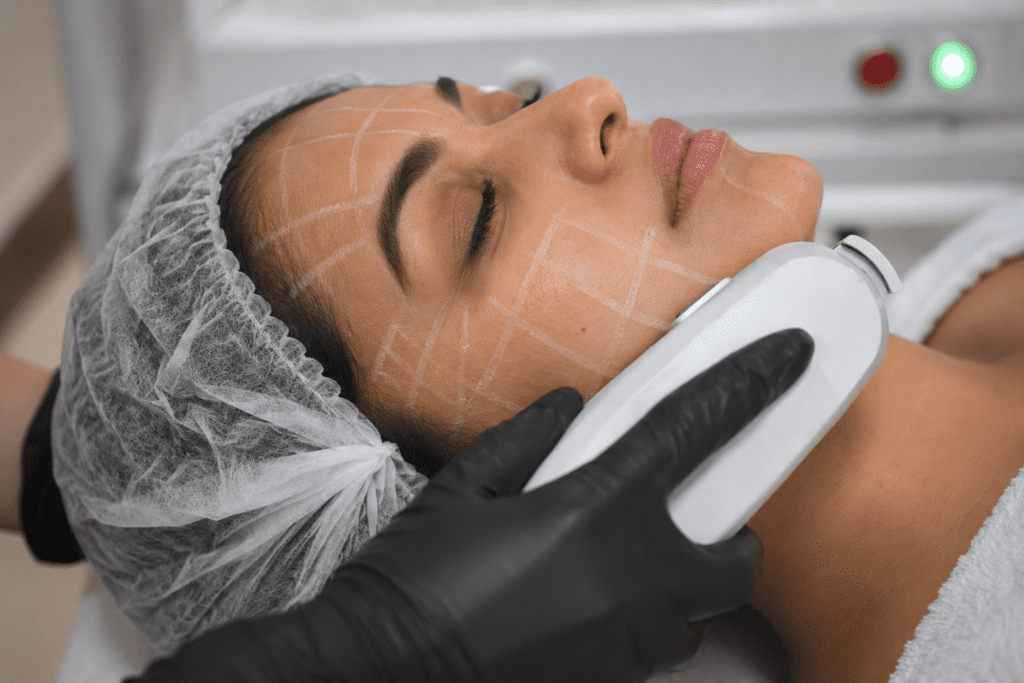 HIFU Skin Tightening Treatment