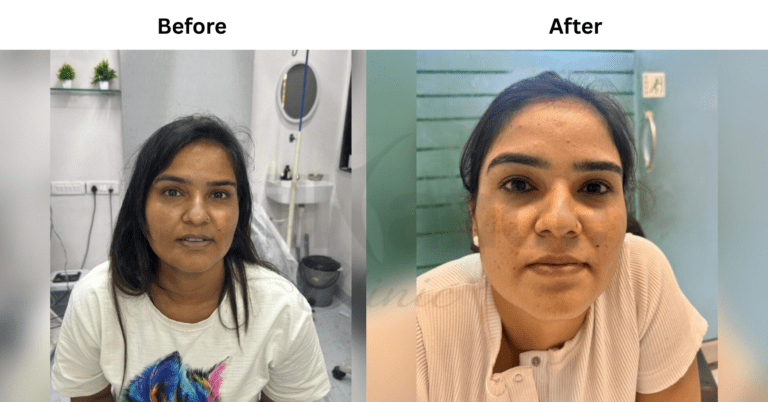glutathione skin transformation Chronic Pain Supplements Reviewed Color:Caramel Lux brain & memory support