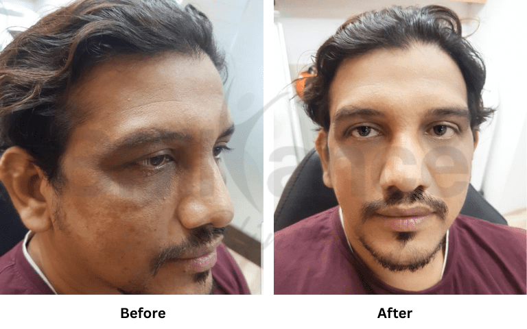 Aesthetic procedure suite at Brilliance Cosmocare Clinic