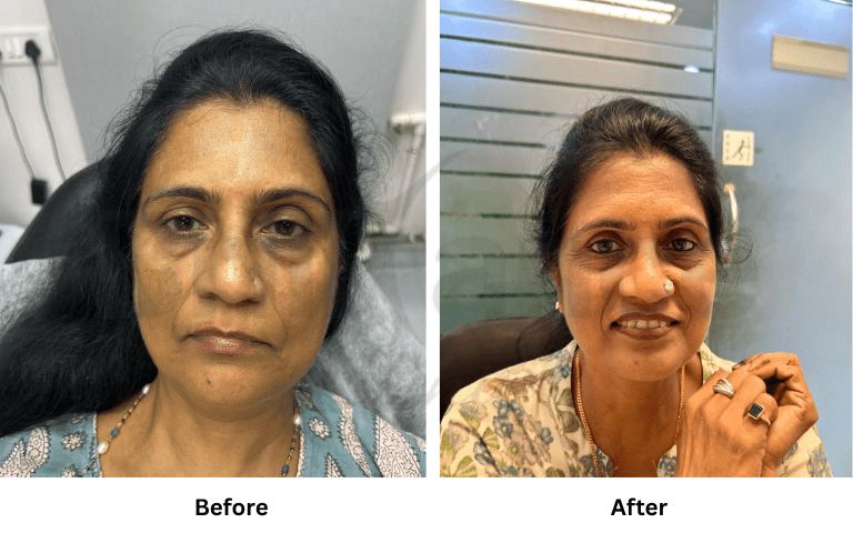 Skin treatment room at Brilliance Cosmocare Clinic Andheri West