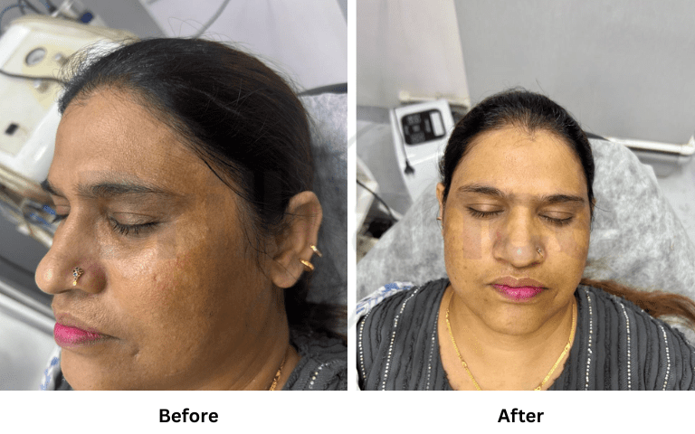 Consultation and treatment area at Brilliance Cosmocare Clinic