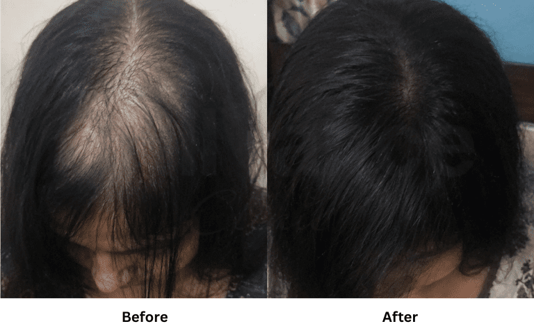 Brilliance cosmocare _ exsorsome