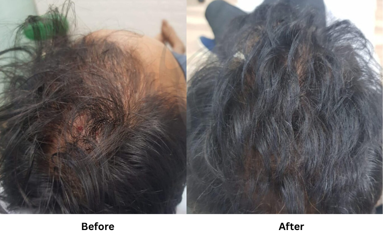 before & after of treatments (29)