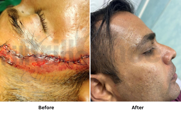 before & after of treatments (30)
