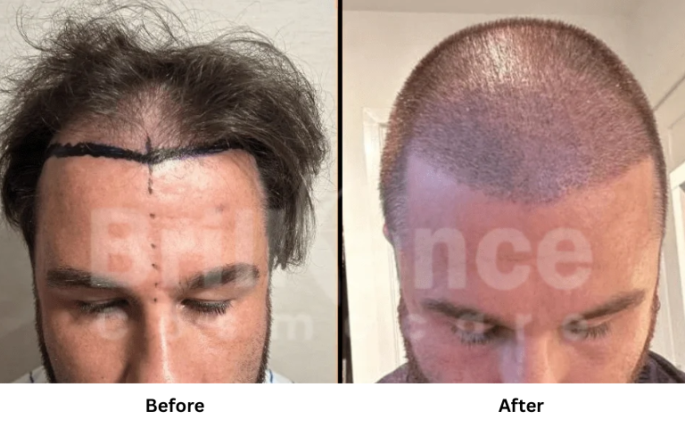 before & after of treatments (31)