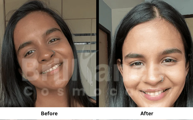 before & after of treatments (32)