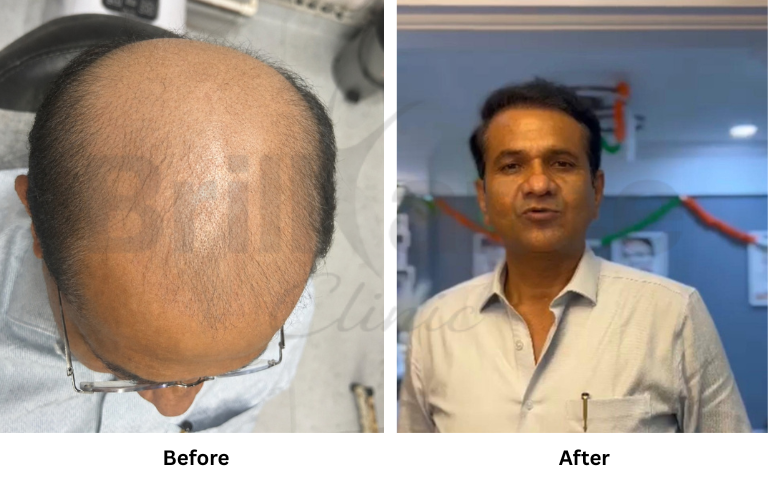 before & after of treatments (34)