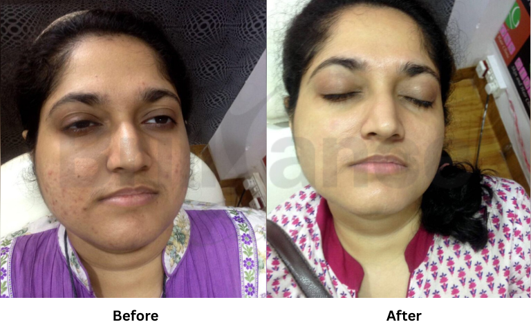 before & after of treatments (35)